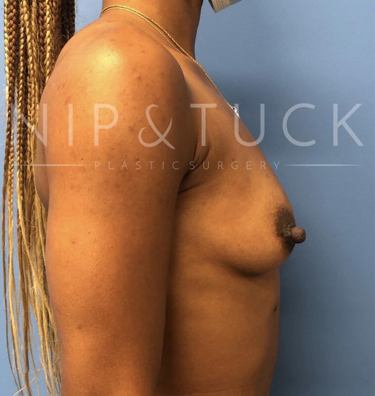 Patient #18 photos